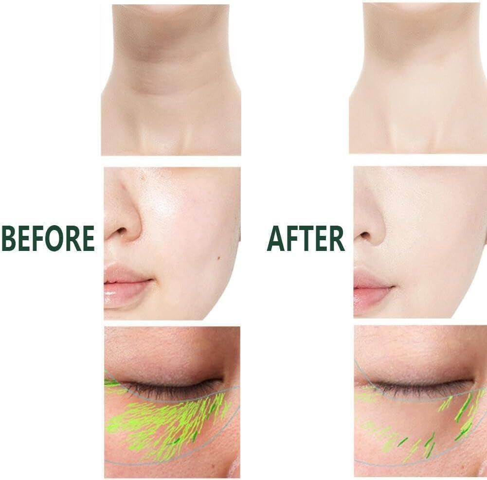 Neck Face Firming Wrinkle Removal Tool